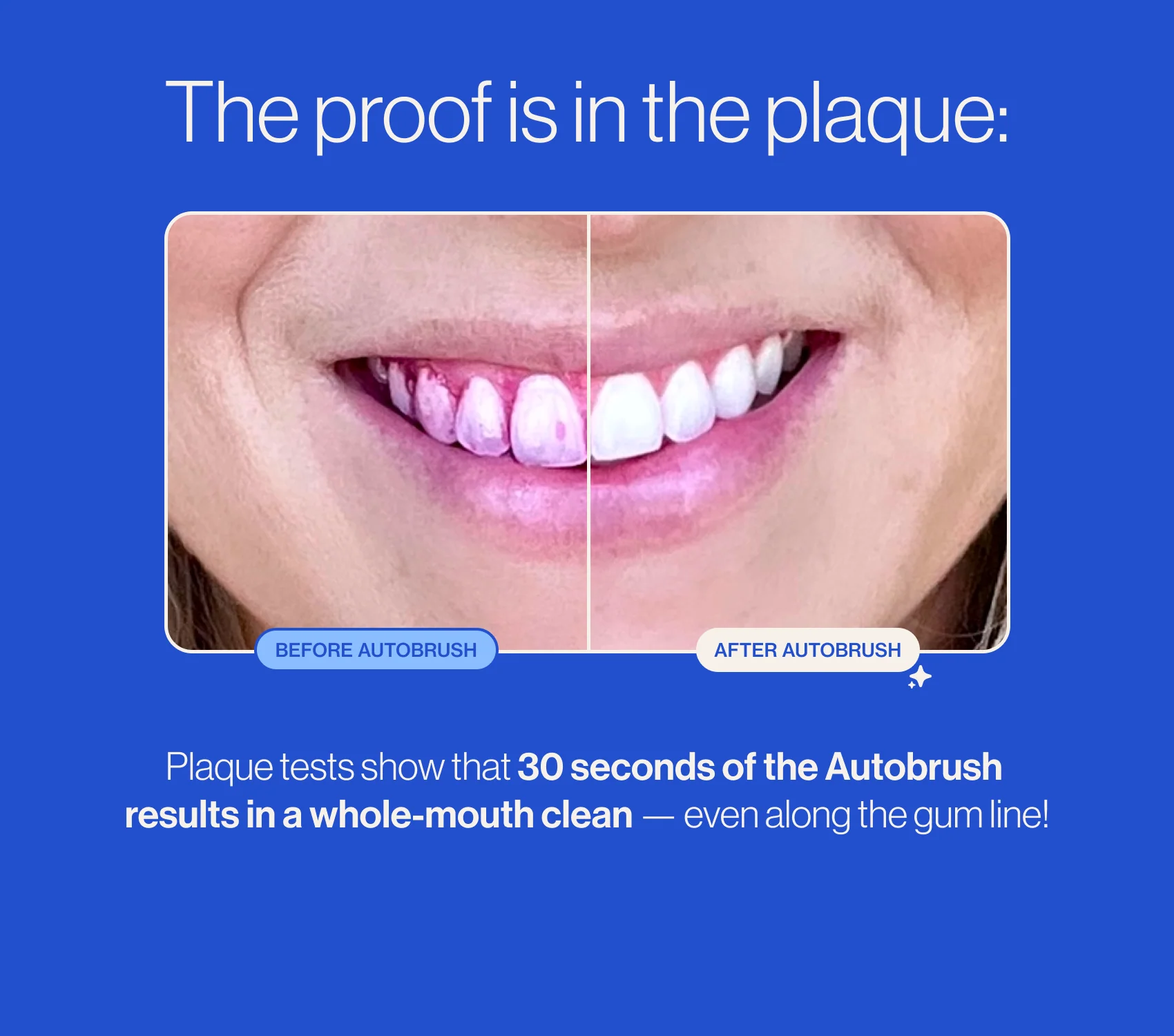 Autobrush® Sonic Pro - Image 9